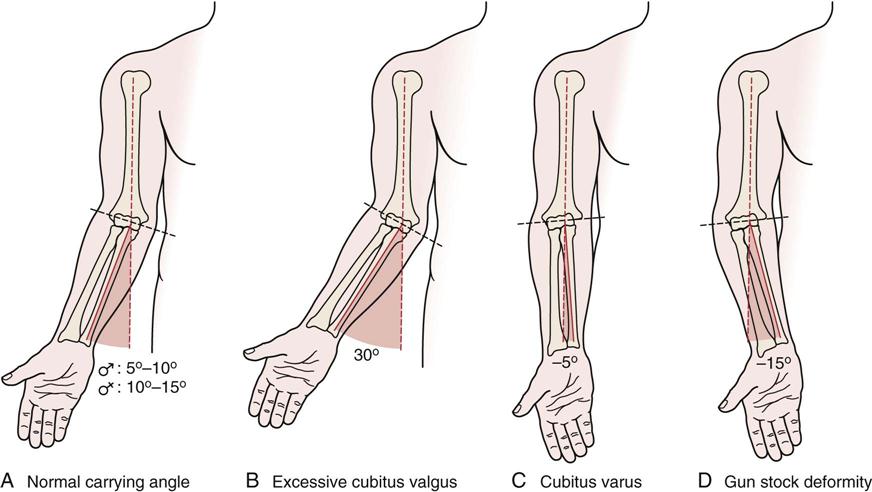 Elbow | Musculoskeletal Key
