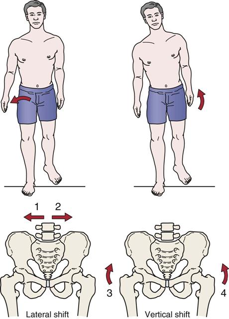 assessment-of-gait-musculoskeletal-key