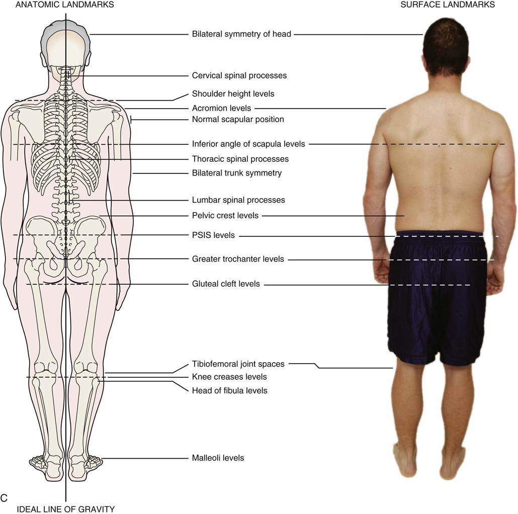 assessment-of-posture-musculoskeletal-key