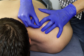 Deep dry needling of the shoulder muscles | Musculoskeletal Key