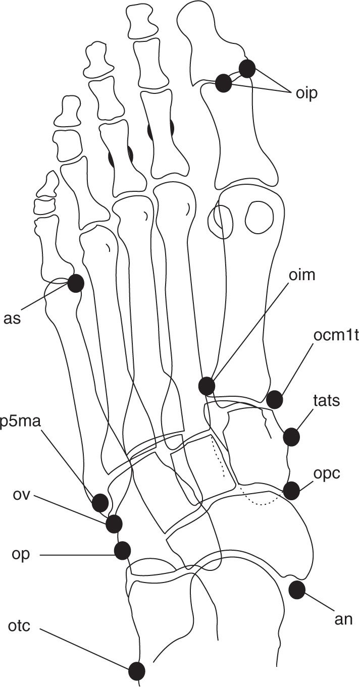 6 Normal Variants And Anomalies Musculoskeletal Key