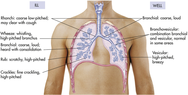 Where Would You Hear Bronchial Breath Sounds