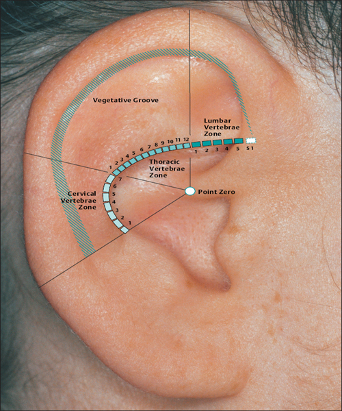 Basic Principles Of Auricular Acupuncture | Musculoskeletal Key