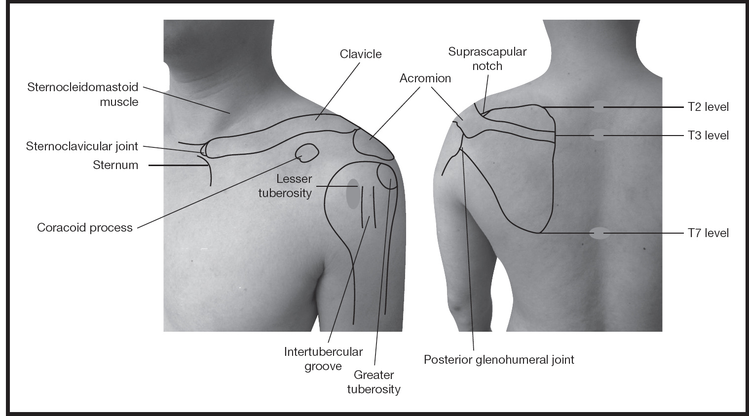 greater tubercle of humerus palpation