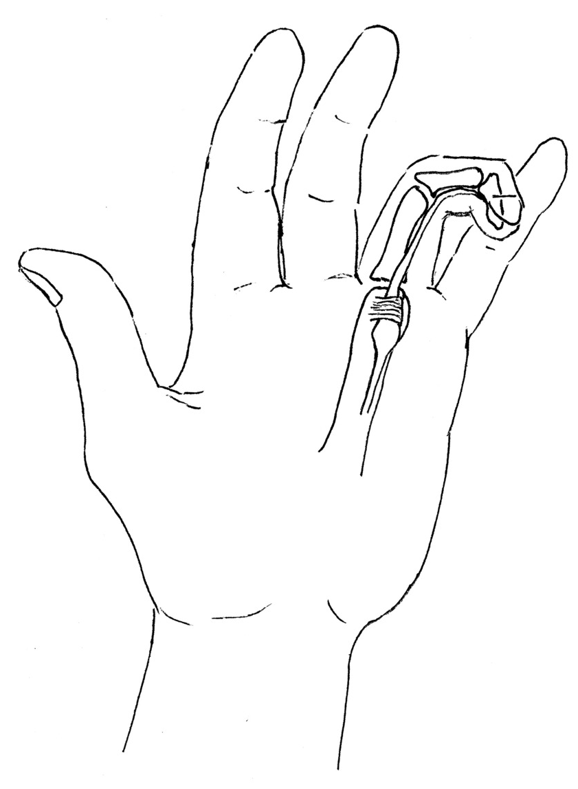 Chapter 4 Hand Musculoskeletal Key 8032