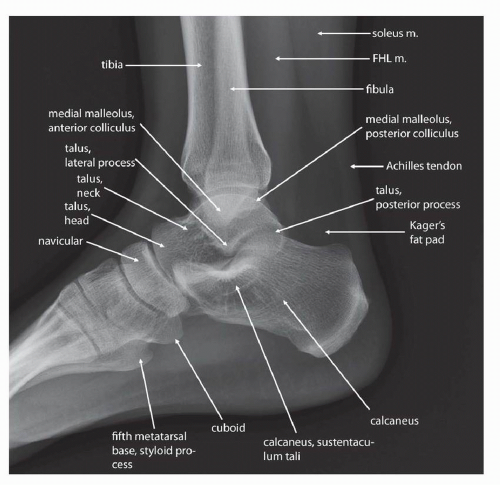 Foot Anatomy X Ray