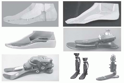 Roll-over shape of a prosthetic foot: a finite element evaluation and  experimental validation | Medical & Biological Engineering & Computing