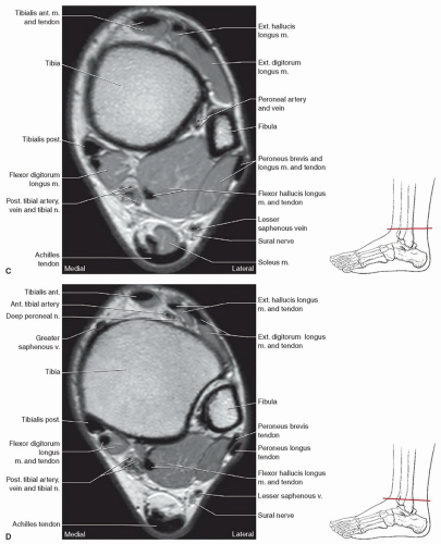 Foot, Ankle, and Calf | Musculoskeletal Key