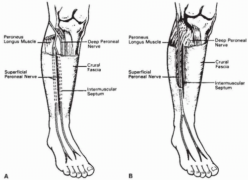 superficial peroneal nerve distribution