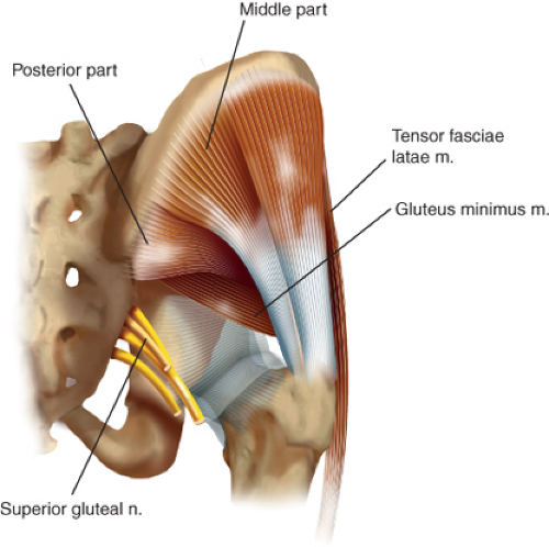 Gluteus Medius Tear, Gluteus Minimus Tear, Orthopedic Hip Specialist