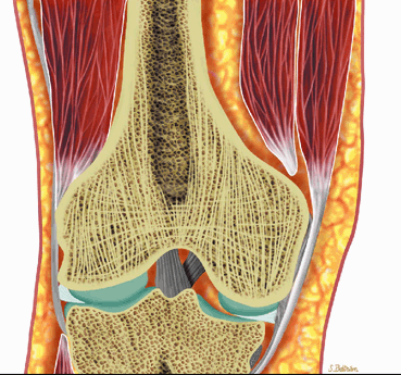 Marrow Imaging | Musculoskeletal Key