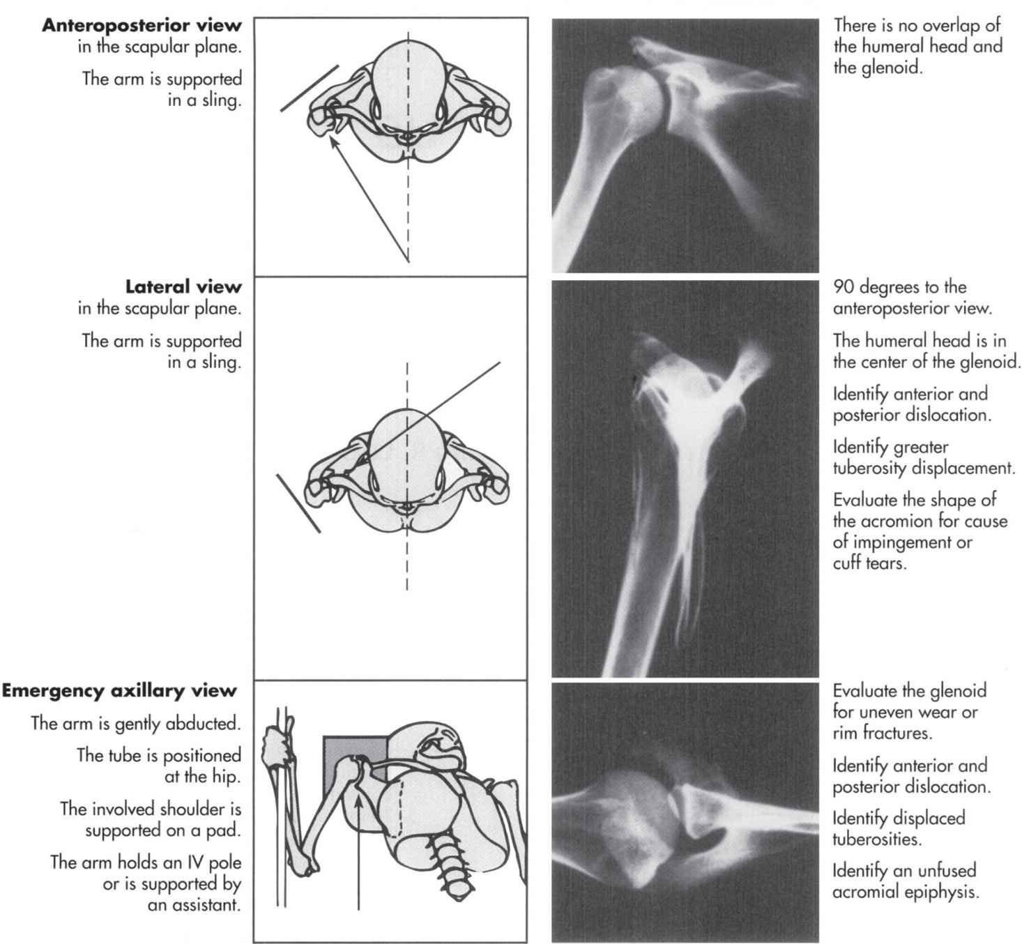 Humerus: Anatomy, Function, Fractures & Causes