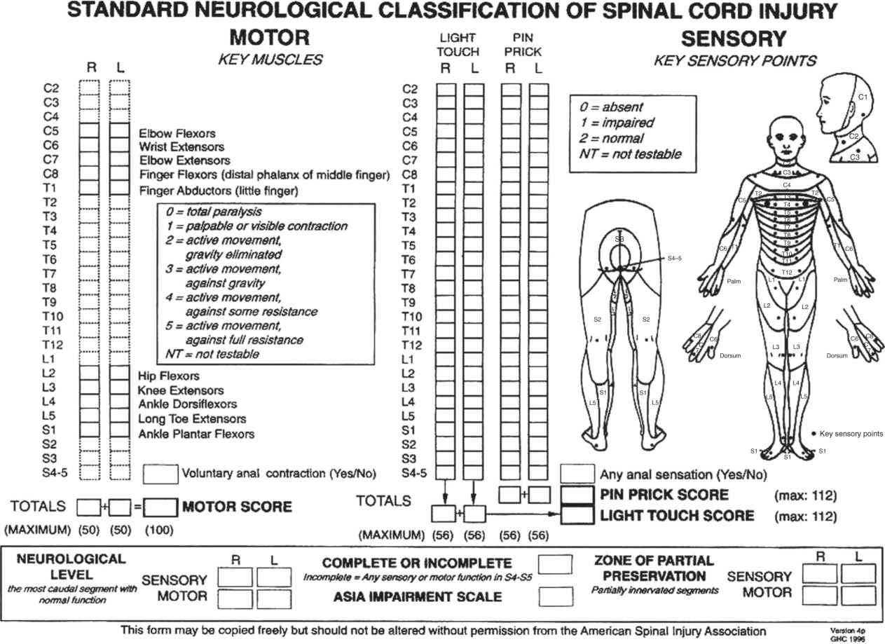 Spinal Cord and Related Injuries | Musculoskeletal Key