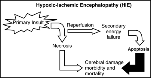 Five Misperceptions About Hypoxic-Ischemic Encephalopathy (HIE)