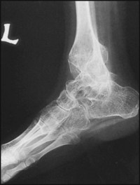 Ankle | Musculoskeletal Key