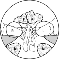 The skull | Musculoskeletal Key