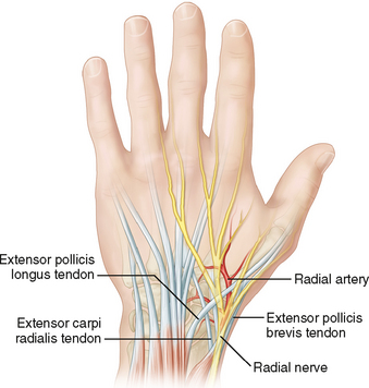 15: Scaphoid Fracture Fixation | Musculoskeletal Key