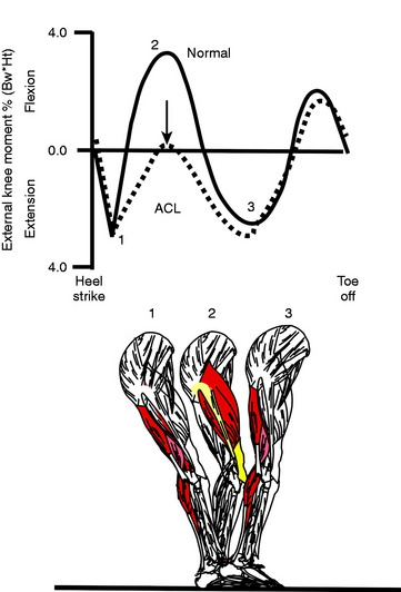 human-movement-and-anterior-cruciate-ligament-function-anterior