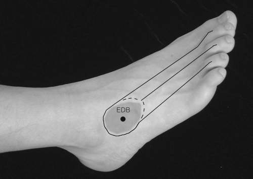 The Foot | Musculoskeletal Key