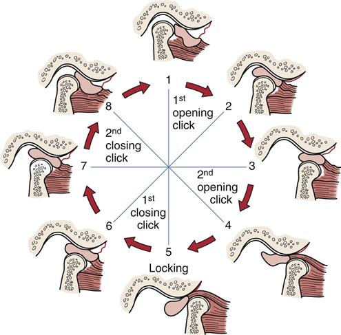 Temporomandibular Joint Musculoskeletal Key