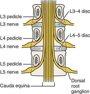 Lumbar Spine | Musculoskeletal Key
