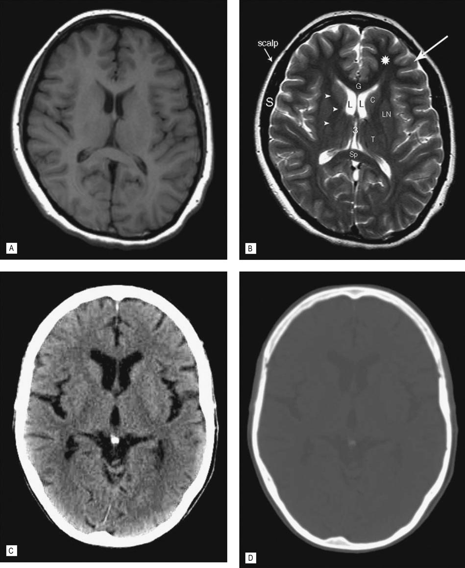 Imaging | Musculoskeletal Key