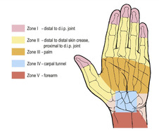 Hand injuries | Musculoskeletal Key