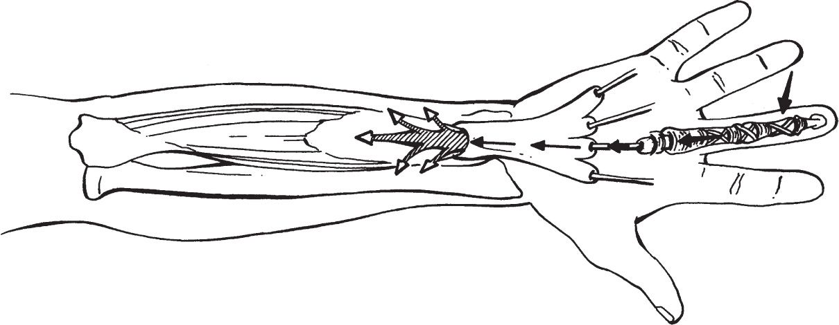 The Diagnosis And Management Of Musculoskeletal Trauma ...