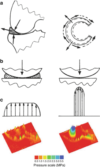 A330151_1_En_25_Fig3_HTML.gif