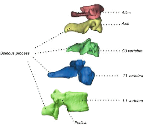 LUMBAR SPINE  Musculoskeletal Key