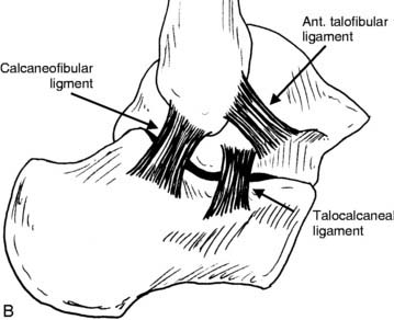 Osteochondral Lesions of the Talus and Occult Fractures of the Foot and