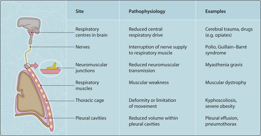 lung disease | Musculoskeletal Key