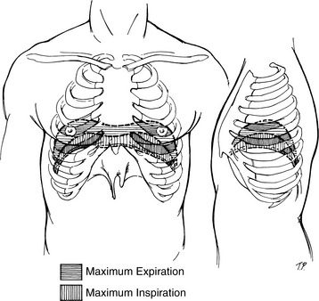 MECHANISM OF INJURY | Musculoskeletal Key