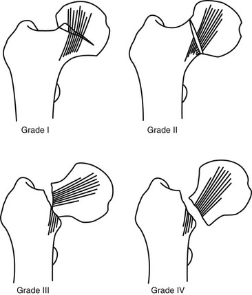 Musculoskeletal System | Musculoskeletal Key