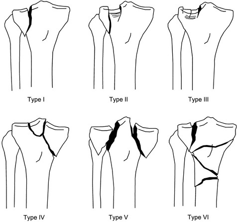 Musculoskeletal System | Musculoskeletal Key