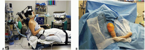 Arthroscopic Setup: Approaches and Tips for Success | Musculoskeletal Key