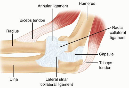 Reconstruction for Missed Monteggia Lesion | Musculoskeletal Key