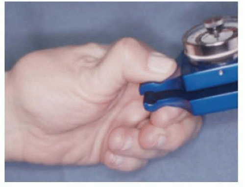 thumb-carpometacarpal-joint-resection-arthroplasty-musculoskeletal-key