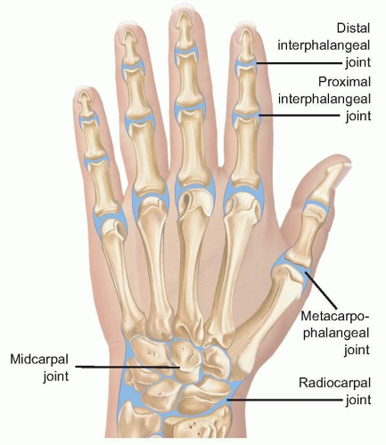 Surgical Treatment of Septic Arthritis in the Hand and Wrist ...
