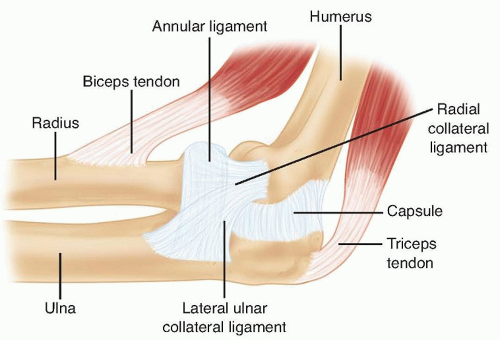Radial Head Replacement | Musculoskeletal Key