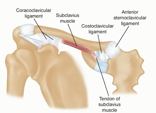 Acute Repair And Reconstruction Of Sternoclavicular Dislocation