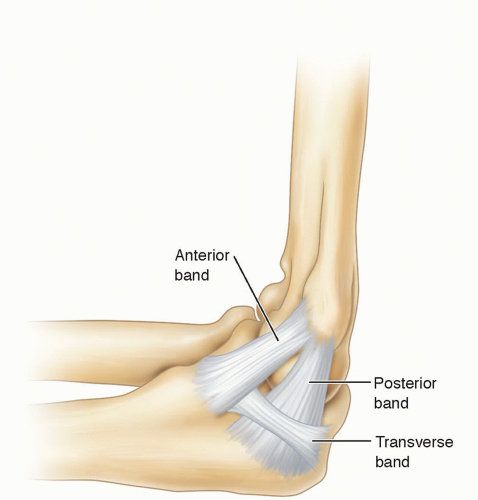 Arthroscopic Treatment of Valgus Extension Overload | Musculoskeletal Key