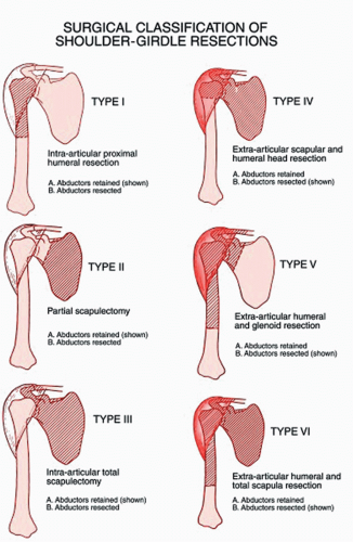 A new classification of the shoulder girdle muscles in domestic