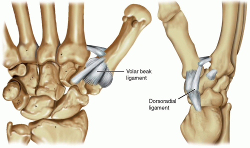 Thumb Mcp Joint Ulnar Collateral Ligament Reconstruct - vrogue.co