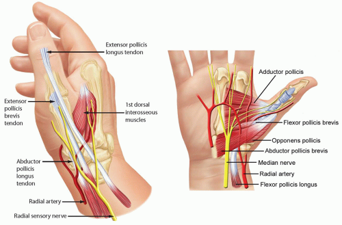 metacarpophalangeal joint dislocation