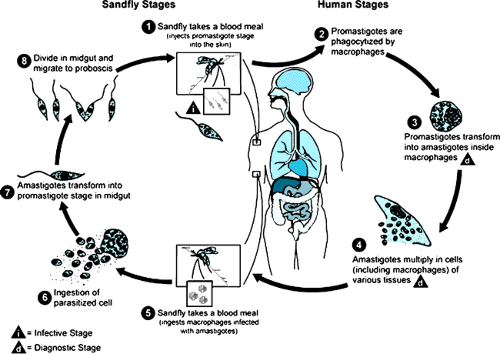 Leishmaniasis | Musculoskeletal Key