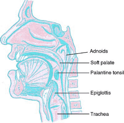 Obstructive Sleep Apnea Syndrome | Musculoskeletal Key