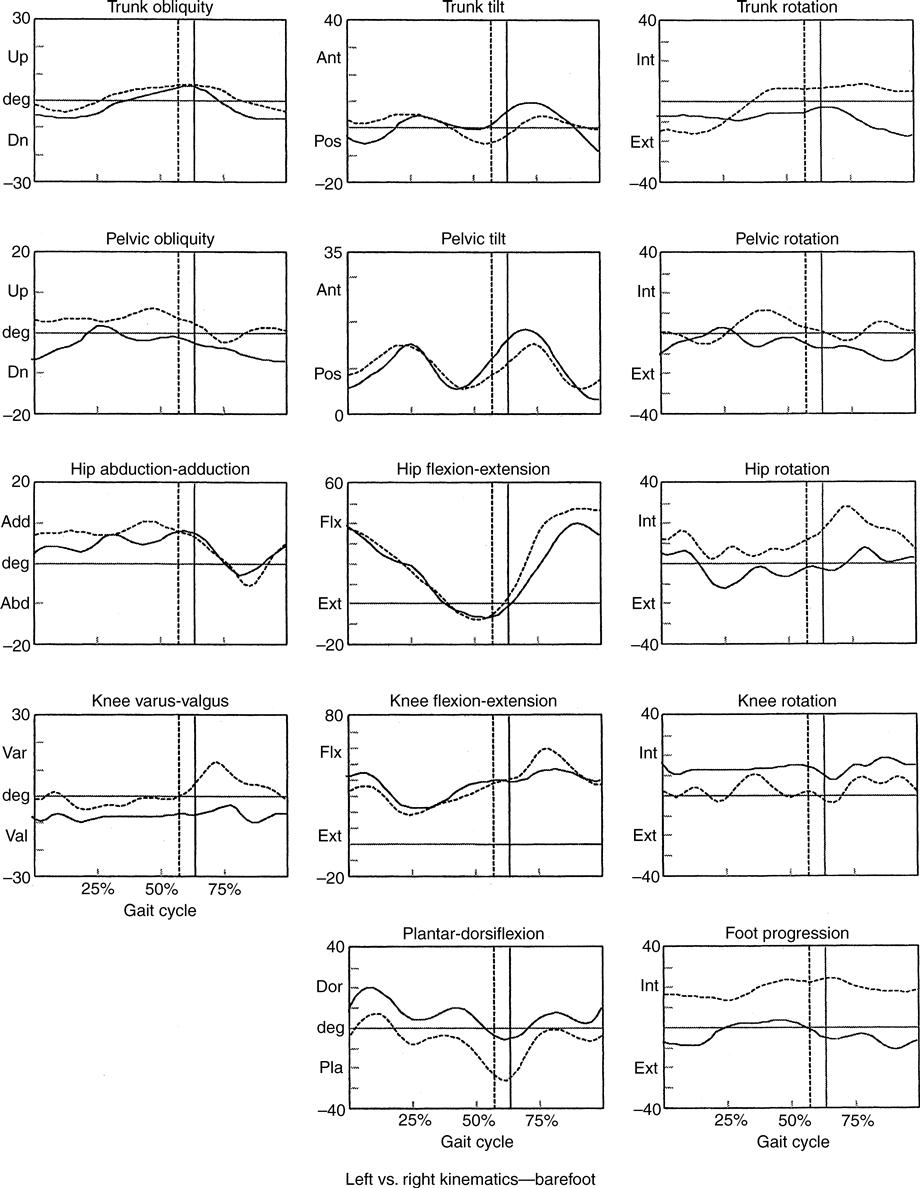 Observational Gait Analysis: Los Amigos Research & Education Center:  9780967633510: : Books