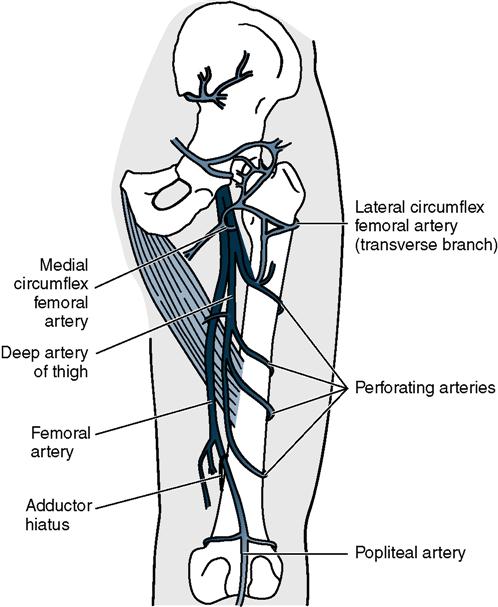 Amputation Surgeries for the Lower Limb | Musculoskeletal Key