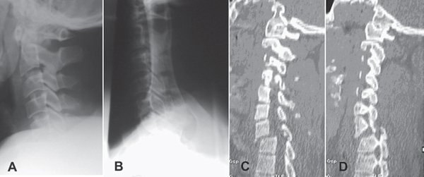 swimmers view x ray